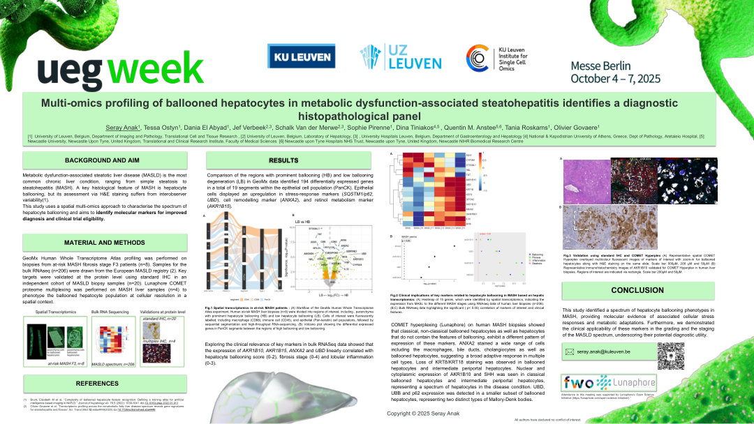 MULTI-OMICS PROFILING OF BALLOONED HEPATOCYTES IN METABOLIC DYSFUNCTION-ASSOCIATED STEATOHEPATITIS IDENTIFIES A DIAGNOSTIC HISTOPATHOLOGICAL PANEL