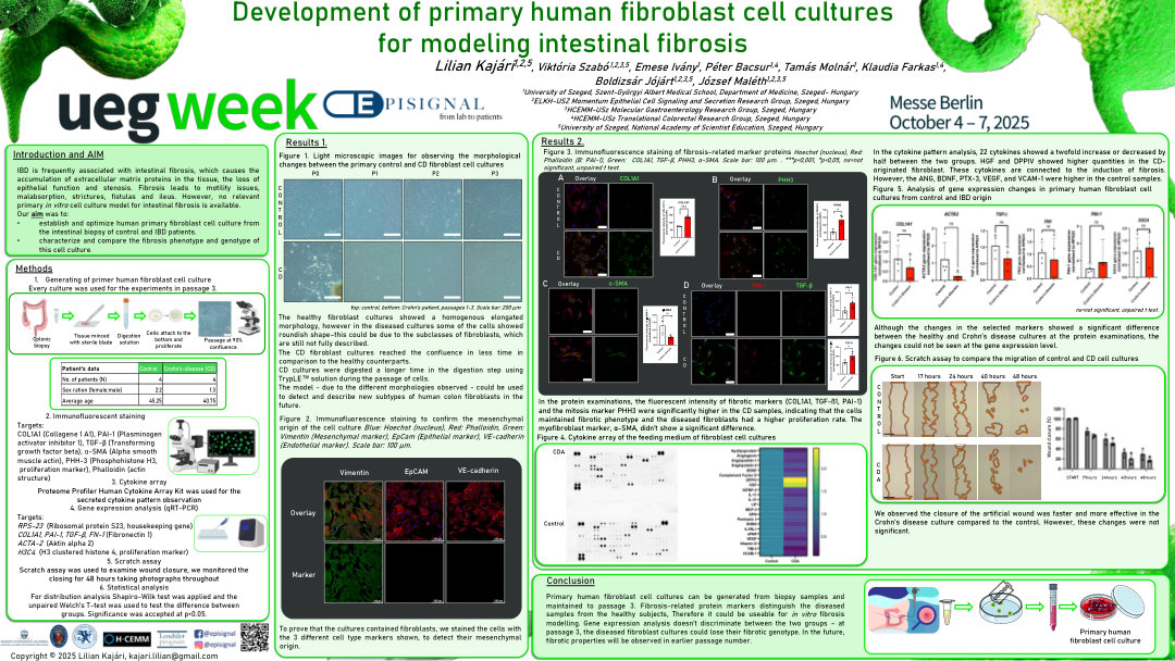 DEVELOPMENT OF PRIMARY HUMAN FIBROBLAST CELL CULTURES FOR MODELING INTESTINAL FIBROSIS