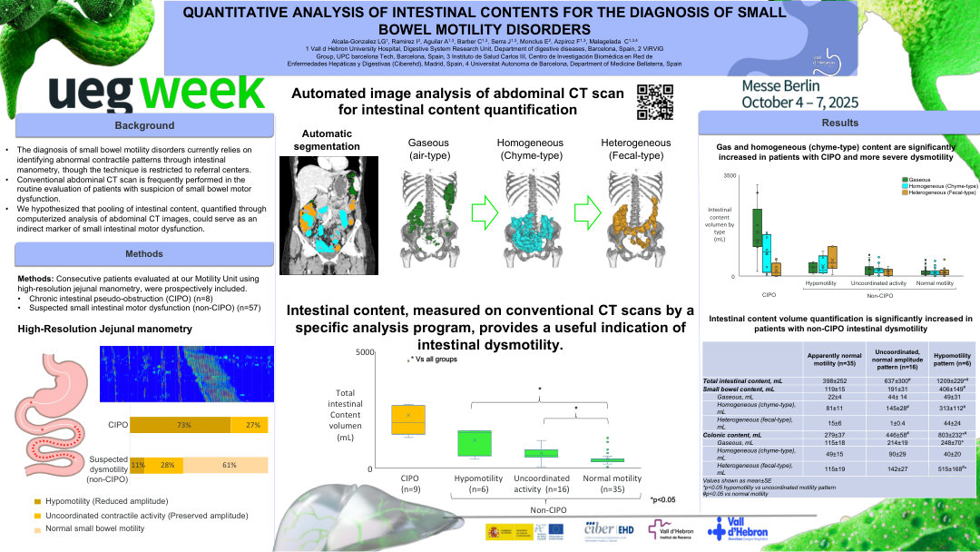 QUANTITATIVE ANALYSIS OF INTESTINAL CONTENTS FOR THE DIAGNOSIS OF SMALL BOWEL MOTILITY DISORDERS
