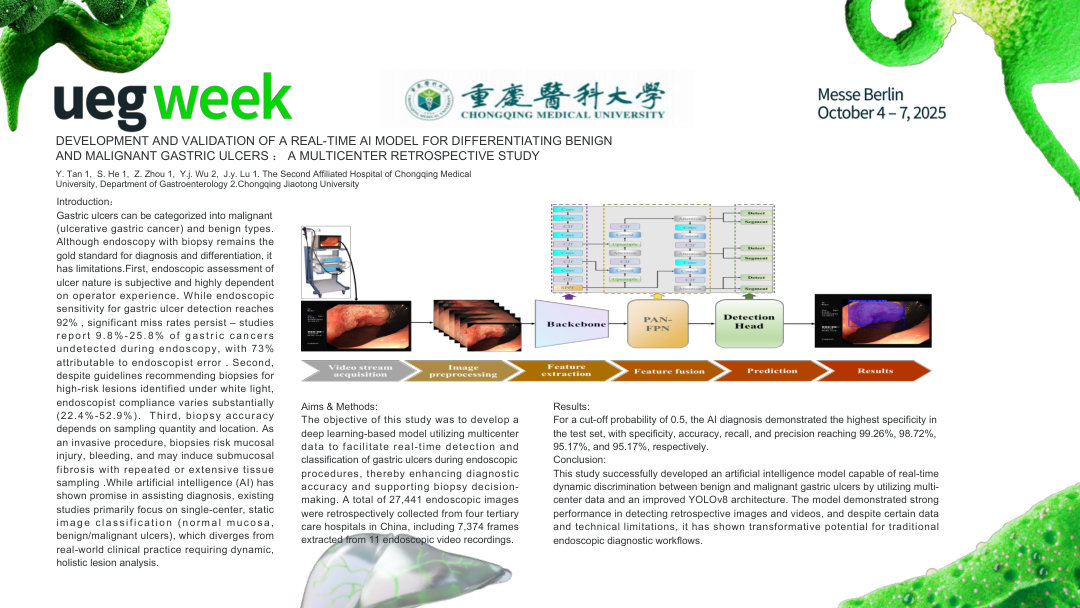 DEVELOPMENT AND VALIDATION OF A REAL-TIME AI MODEL FOR DIFFERENTIATING BENIGN AND MALIGNANT GASTRIC ULCERS ： A MULTICENTER RETROSPECTIVE STUDY