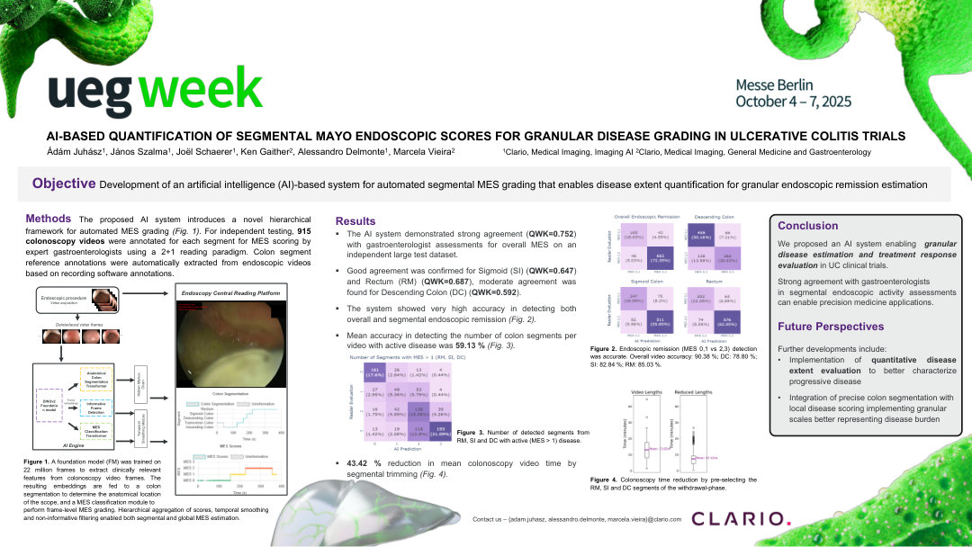 AI-BASED QUANTIFICATION OF SEGMENTAL MAYO ENDOSCOPIC SCORES FOR GRANULAR DISEASE GRADING IN ULCERATIVE COLITIS TRIALS