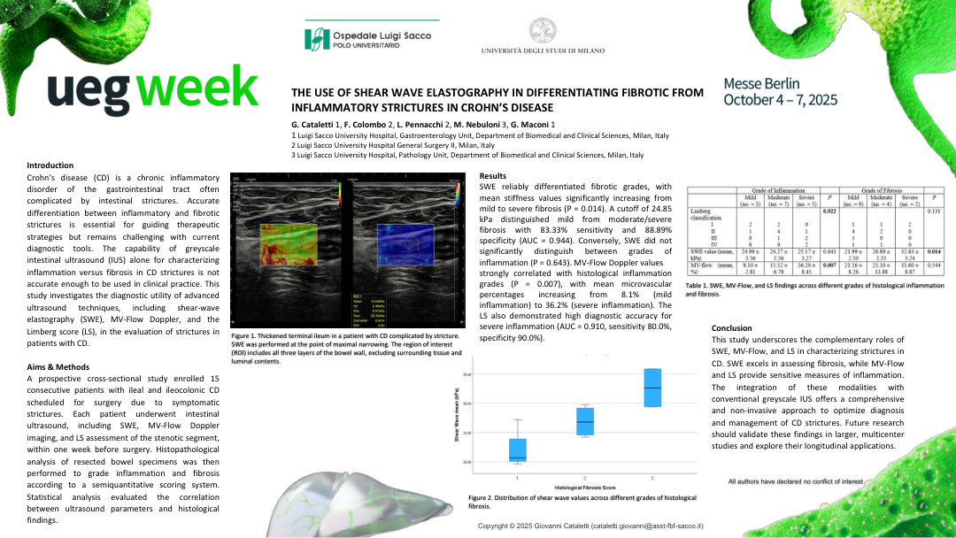 THE USE OF SHEAR WAVE ELASTOGRAPHY IN DIFFERENTIATING FIBROTIC FROM INFLAMMATORY STRICTURES IN CROHN’S DISEASE
