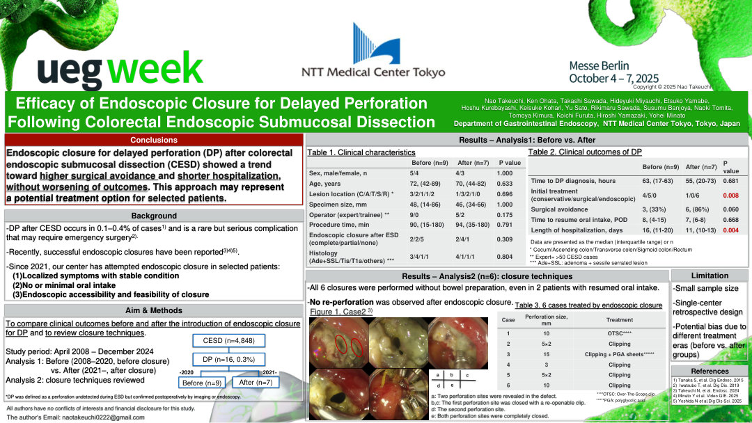 EFFICACY OF ENDOSCOPIC CLOSURE FOR DELAYED PERFORATION FOLLOWING COLORECTAL ENDOSCOPIC SUBMUCOSAL DISSECTION