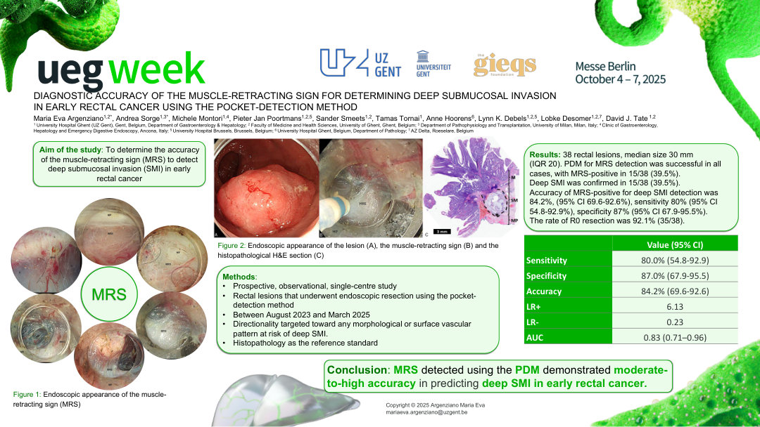 DIAGNOSTIC ACCURACY OF THE MUSCLE-RETRACTING SIGN FOR DETERMINING DEEP SUBMUCOSAL INVASION IN EARLY RECTAL CANCER USING THE POCKET-DETECTION METHOD