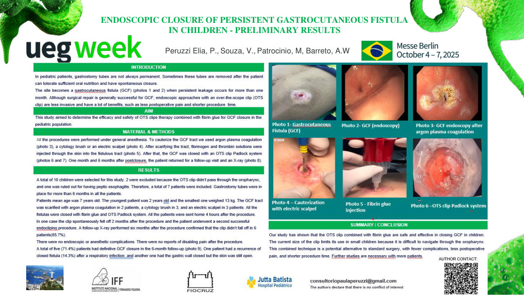 ENDOSCOPIC CLOSURE OF PERSISTENT GASTROCUTANEOUS FISTULAS IN CHILDREN - PRELIMINARY RESULTS
