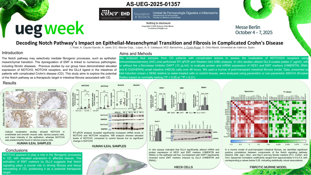 DECODING NOTCH PATHWAY’S IMPACT ON EPITHELIAL-MESENCHYMAL TRANSITION AND FIBROSIS IN COMPLICATED CROHN'S DISEASE