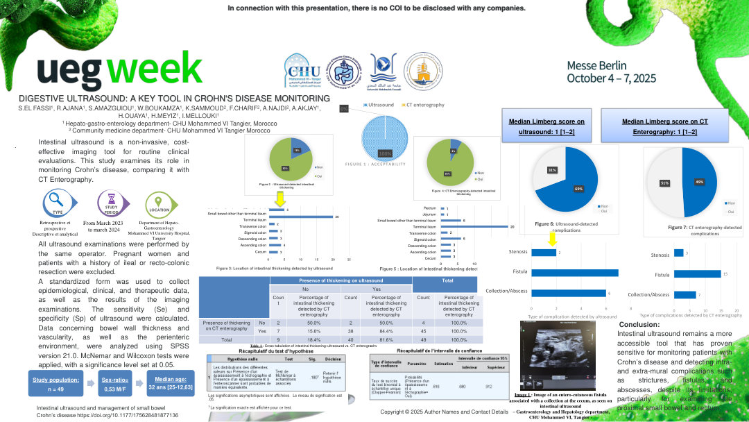 DIGESTIVE ULTRASOUND: A KEY TOOL IN CROHN'S DISEASE MONITORING