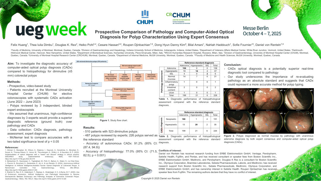 PROSPECTIVE COMPARISON OF PATHOLOGY AND COMPUTER-AIDED OPTICAL DIAGNOSIS FOR POLYP CHARACTERIZATION USING EXPERT CONSENSUS