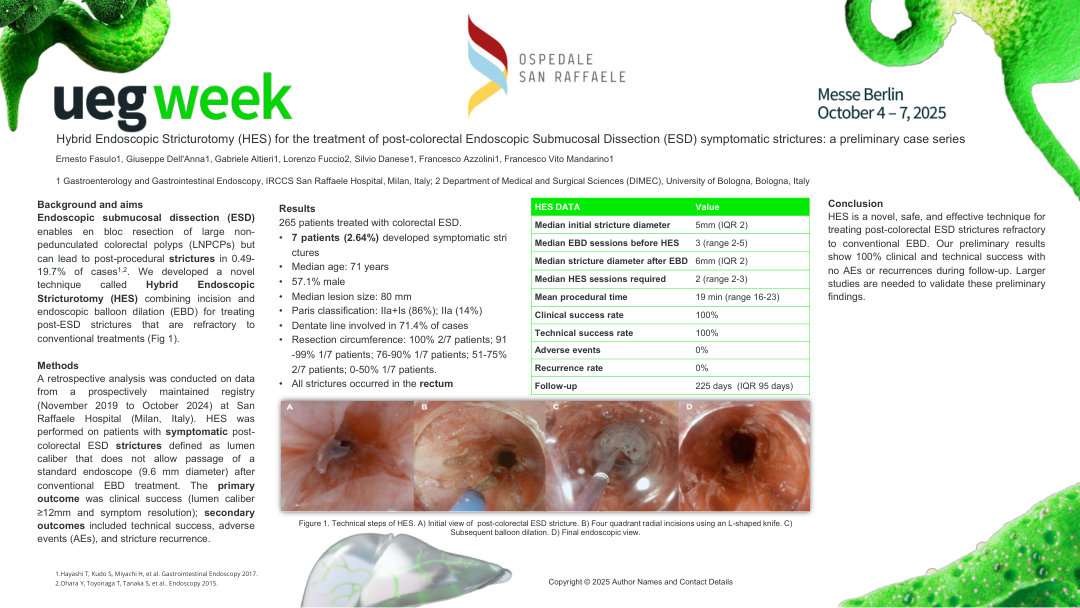HYBRID ENDOSCOPIC STRICTUROTOMY FOR THE TREATMENT OF POST-COLORECTAL ESD SYMPTOMATIC STRICTURES: A PRELIMINARY CASE SERIES