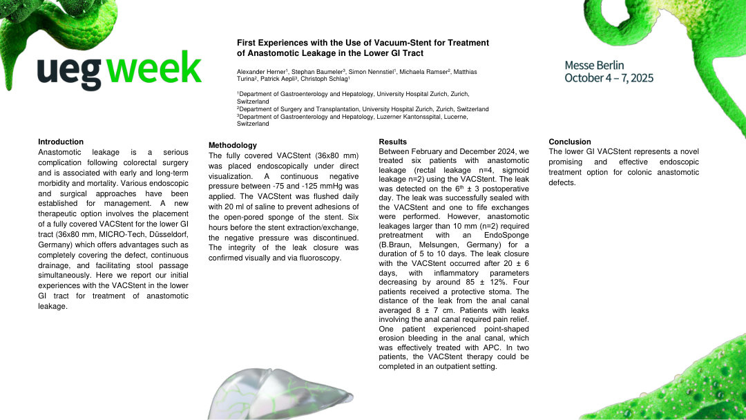 FIRST EXPERIENCES WITH THE USE OF VACUUM-STENT FOR TREATMENT OF ANASTOMOTIC LEAKAGE IN THE LOWER GI TRACT