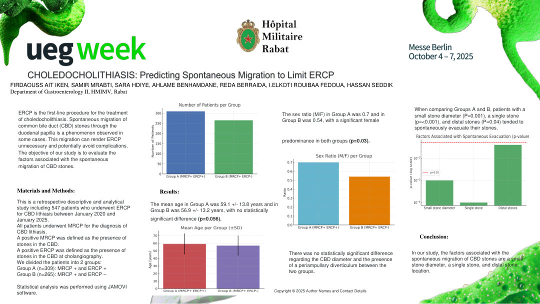 CHOLEDOCHOLITHIASIS: PREDICTING SPONTANEOUS MIGRATION TO LIMIT ERCP