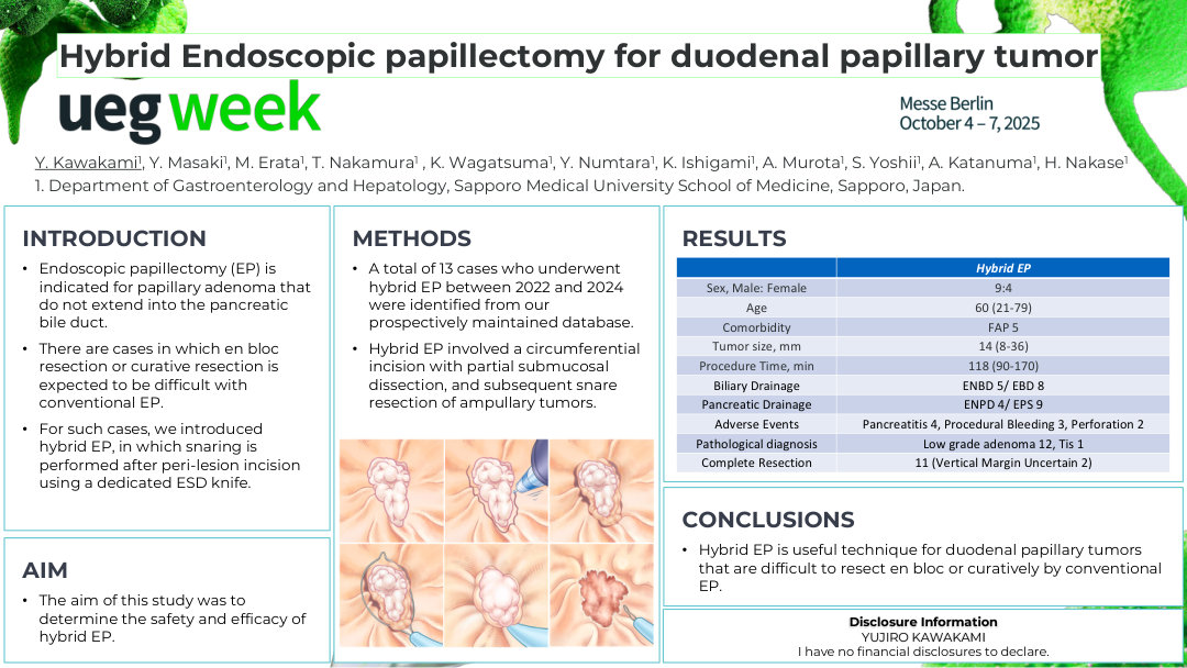 HYBRID ENDOSCOPIC PAPILLECTOMY FOR DUODENAL PAPILLARY TUMOR
