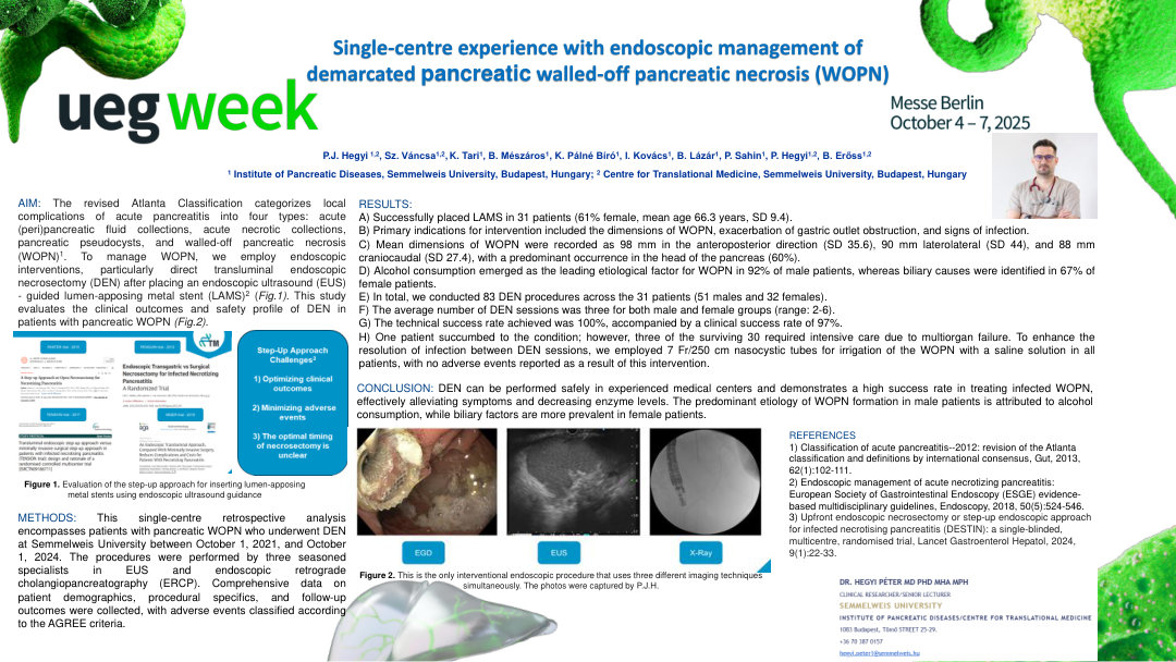 SINGLE-CENTER EXPERIENCE WITH ENDOSCOPIC MANAGEMENT OF DEMARCATED PANCREATIC WALLED-OFF PANCREATIC NECROSIS (WOPN)