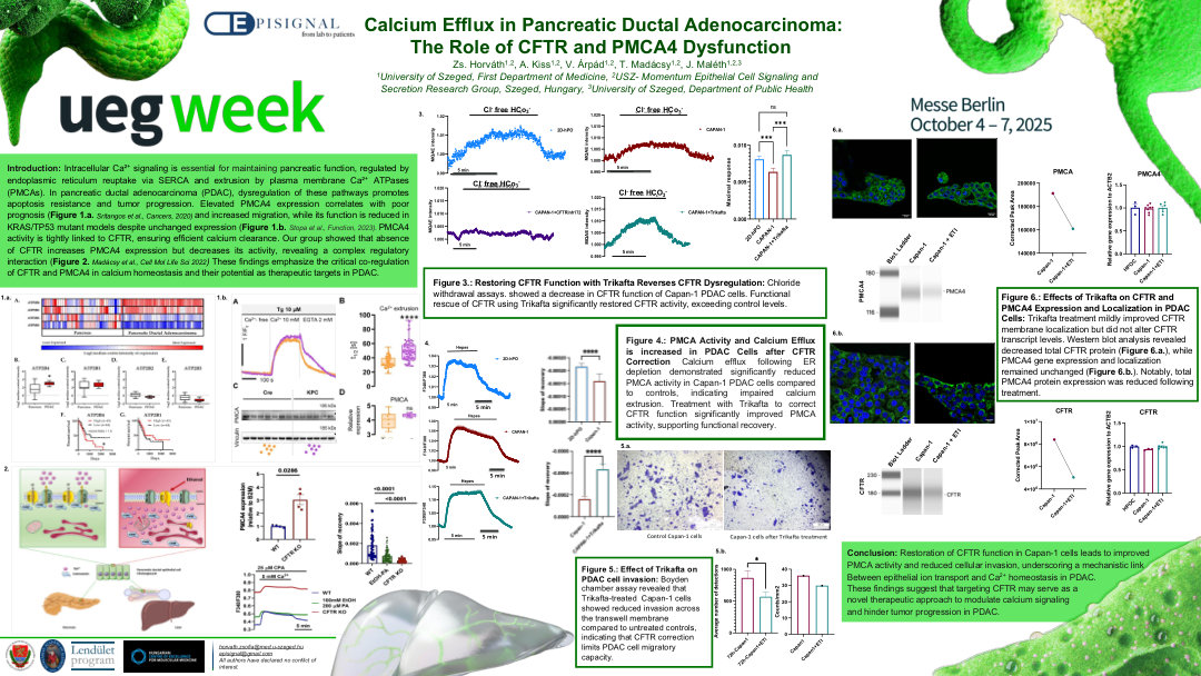 DISRUPTED CALCIUM EFFLUX IN PANCREATIC DUCTAL ADENOCARCINOMA: THE ROLE OF CFTR AND PMCA4 DYSFUNCTION